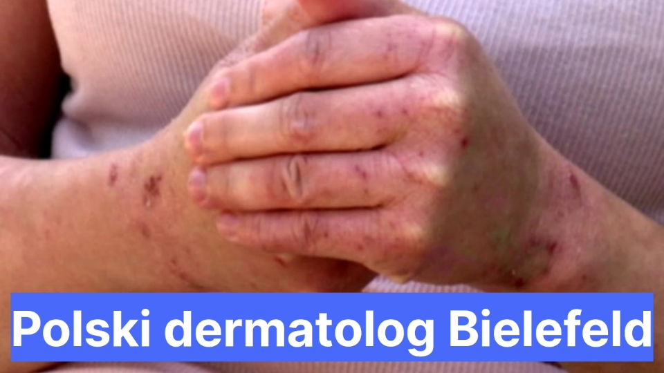 Polski Dermatolog Bielefeld Polacy W Niemczech 0877