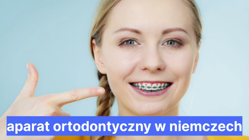 Aparat Ortodontyczny W Niemczech Polacy W Niemczech 6875