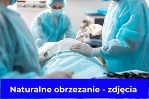 Naturalne obrzezanie - zdjęcia