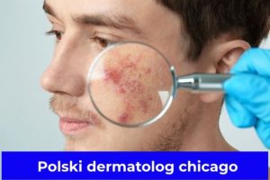 Polski dermatolog chicago