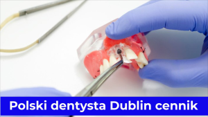 Polski dentysta Dublin cennik